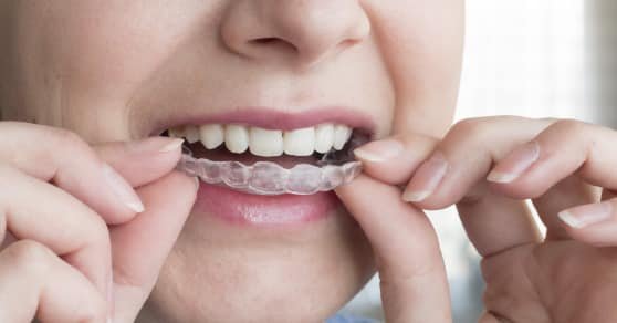 SG 牙齿矫正推荐